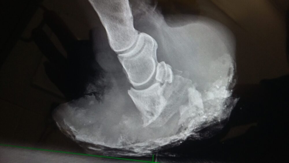 severe laminitis xray
